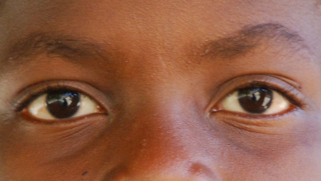 “The Carcass Remover”